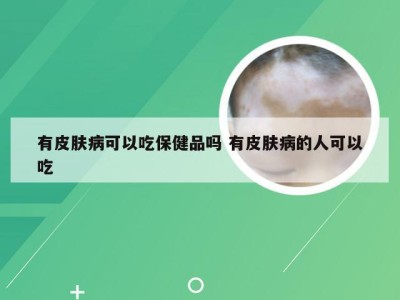 有皮肤病可以吃保健品吗 有皮肤病的人可以吃