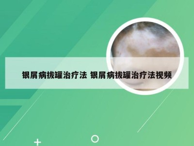 银屑病拔罐治疗法 银屑病拔罐治疗法视频