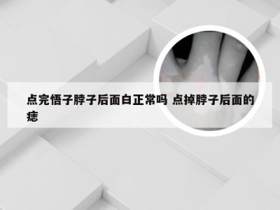 点完悟子脖子后面白正常吗 点掉脖子后面的痣