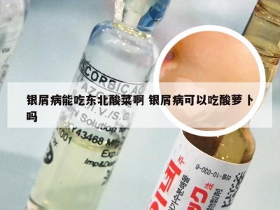 银屑病能吃东北酸菜啊 银屑病可以吃酸萝卜吗