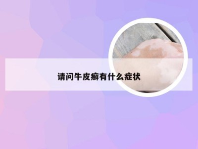 请问牛皮癣有什么症状