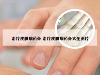 治疗皮肤病药膏 治疗皮肤病药膏大全图片