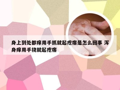 身上到处都痒用手抓就起疙瘩是怎么回事 浑身痒用手挠就起疙瘩