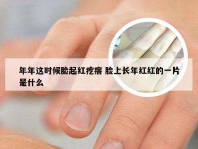 年年这时候脸起红疙瘩 脸上长年红红的一片是什么