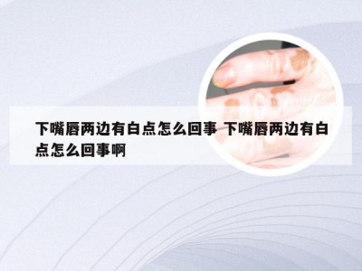 下嘴唇两边有白点怎么回事 下嘴唇两边有白点怎么回事啊