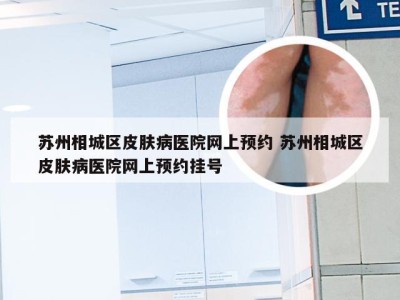 苏州相城区皮肤病医院网上预约 苏州相城区皮肤病医院网上预约挂号