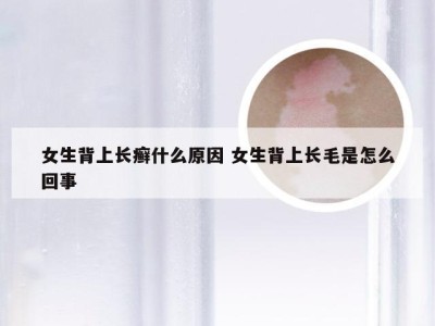 女生背上长癣什么原因 女生背上长毛是怎么回事