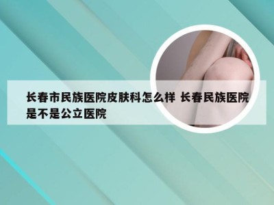 长春市民族医院皮肤科怎么样 长春民族医院是不是公立医院