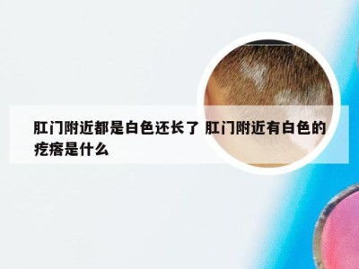 肛门附近都是白色还长了 肛门附近有白色的疙瘩是什么