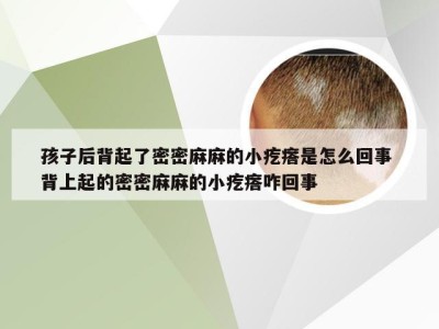 孩子后背起了密密麻麻的小疙瘩是怎么回事 背上起的密密麻麻的小疙瘩咋回事