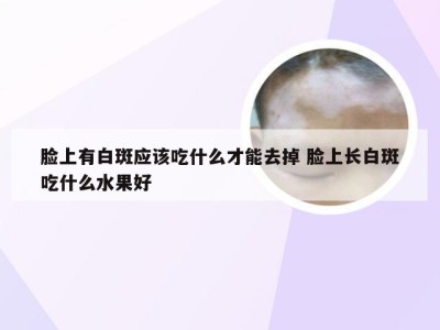 脸上有白斑应该吃什么才能去掉 脸上长白斑吃什么水果好