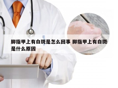 脚指甲上有白斑是怎么回事 脚指甲上有白斑是什么原因