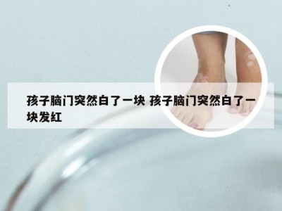 孩子脑门突然白了一块 孩子脑门突然白了一块发红