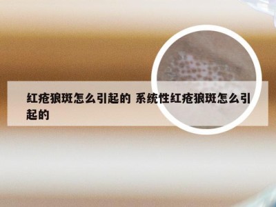 红疮狼斑怎么引起的 系统性红疮狼斑怎么引起的