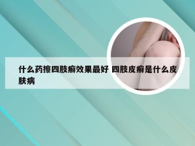 什么药擦四肢癣效果最好 四肢皮癣是什么皮肤病