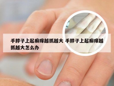 手脖子上起癣痒越抓越大 手脖子上起癣痒越抓越大怎么办