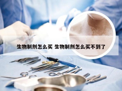 生物制剂怎么买 生物制剂怎么买不到了