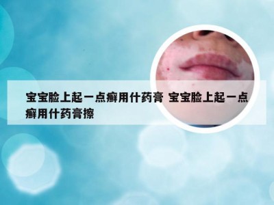 宝宝脸上起一点癣用什药膏 宝宝脸上起一点癣用什药膏擦