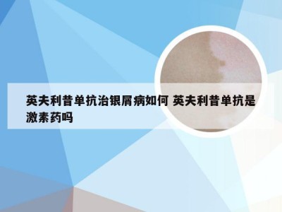 英夫利昔单抗治银屑病如何 英夫利昔单抗是激素药吗