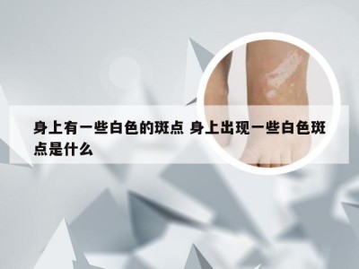 身上有一些白色的斑点 身上出现一些白色斑点是什么