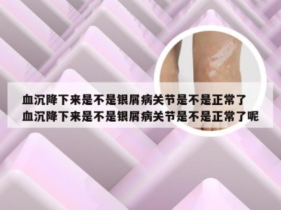 血沉降下来是不是银屑病关节是不是正常了 血沉降下来是不是银屑病关节是不是正常了呢