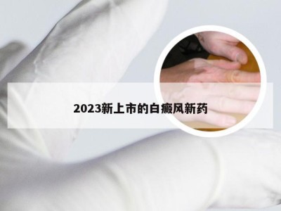 2023新上市的白癜风新药