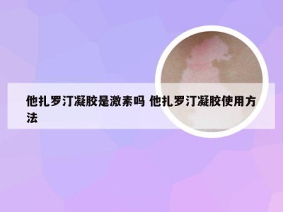 他扎罗汀凝胶是激素吗 他扎罗汀凝胶使用方法