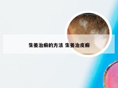 生姜治癣的方法 生姜治皮癣