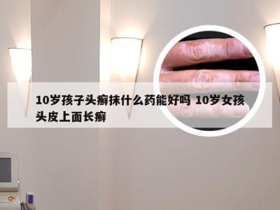 10岁孩子头癣抹什么药能好吗 10岁女孩头皮上面长癣