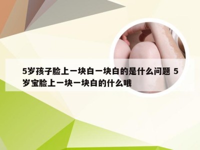 5岁孩子脸上一块白一块白的是什么问题 5岁宝脸上一块一块白的什么哦