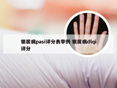 银屑病pasi评分表举例 银屑病dlqi评分