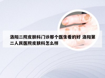 洛阳二院皮肤科门诊那个医生看的好 洛阳第二人民医院皮肤科怎么样