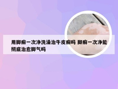 用脚癣一次净洗澡治牛皮癣吗 脚癣一次净能彻底治愈脚气吗