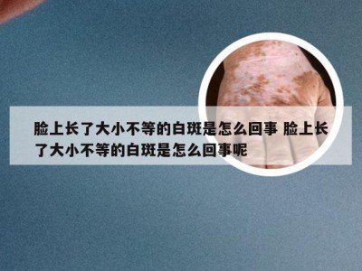 脸上长了大小不等的白斑是怎么回事 脸上长了大小不等的白斑是怎么回事呢