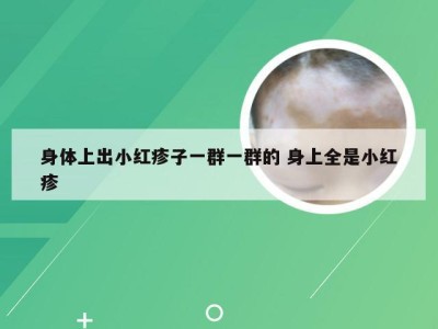 身体上出小红疹子一群一群的 身上全是小红疹