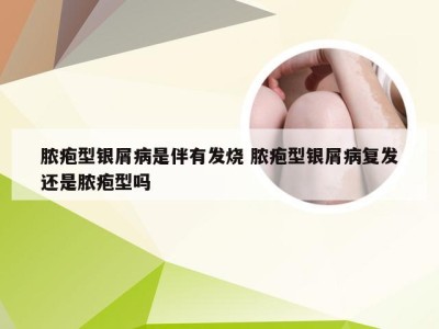 脓疱型银屑病是伴有发烧 脓疱型银屑病复发还是脓疱型吗