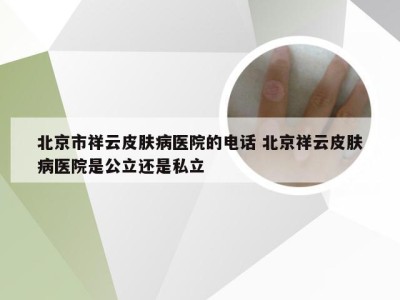 北京市祥云皮肤病医院的电话 北京祥云皮肤病医院是公立还是私立