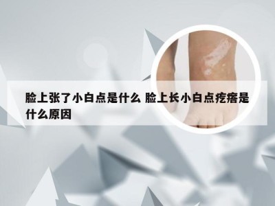 脸上张了小白点是什么 脸上长小白点疙瘩是什么原因