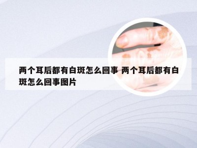 两个耳后都有白斑怎么回事 两个耳后都有白斑怎么回事图片