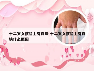 十二岁女孩脸上有白块 十二岁女孩脸上有白块什么原因