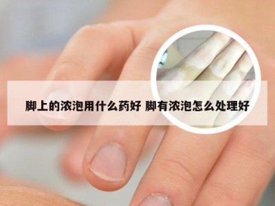 脚上的浓泡用什么药好 脚有浓泡怎么处理好