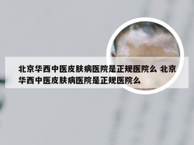 北京华西中医皮肤病医院是正规医院么 北京华西中医皮肤病医院是正规医院么