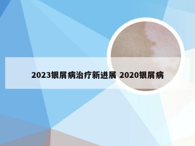 2023银屑病治疗新进展 2020银屑病