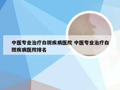 中医专业治疗白斑疾病医院 中医专业治疗白斑疾病医院排名