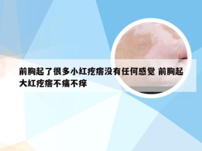 前胸起了很多小红疙瘩没有任何感觉 前胸起大红疙瘩不痛不痒