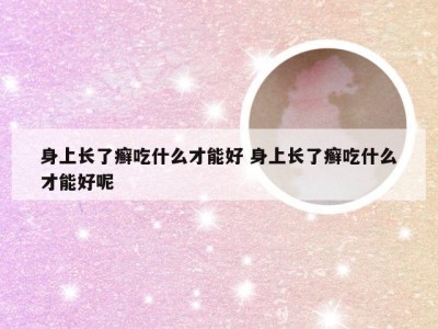 身上长了癣吃什么才能好 身上长了癣吃什么才能好呢