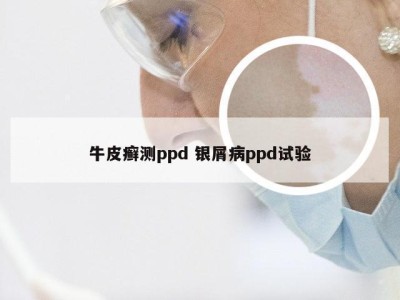 牛皮癣测ppd 银屑病ppd试验