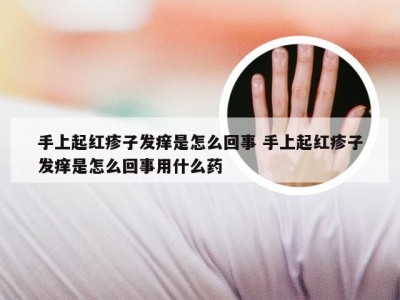 手上起红疹子发痒是怎么回事 手上起红疹子发痒是怎么回事用什么药