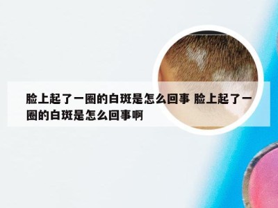 脸上起了一圈的白斑是怎么回事 脸上起了一圈的白斑是怎么回事啊