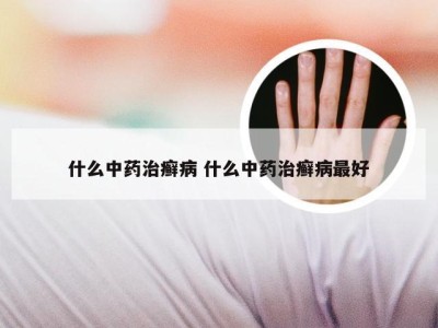 什么中药治癣病 什么中药治癣病最好